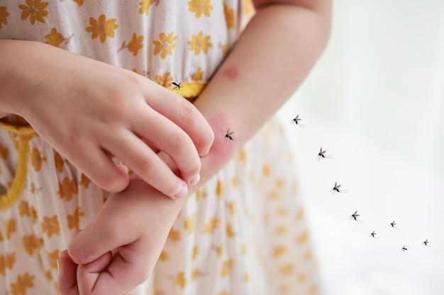 Photo little girl has skin rash allergy and itchy on her arm from mosquito bite