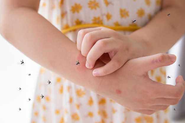 У маленькой девочки аллергия на кожную сыпь и зуд на руке от укуса комара