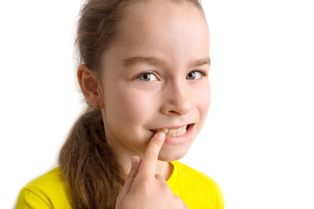 Little girl stands on a white background with a beautiful smile, children crooked teeth, pediatric dentistry. Crooked teeth close-up. Correction of malocclusion is required. High quality photo