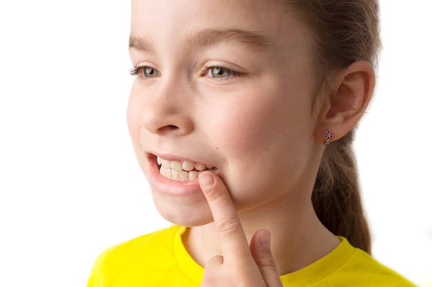Маленькая девочка стоит на белом фоне с красивой улыбкой, детские кривые зубы, детская стоматология. Кривые зубы крупным планом. Требуется исправление неправильного прикуса. Фото высокого качества