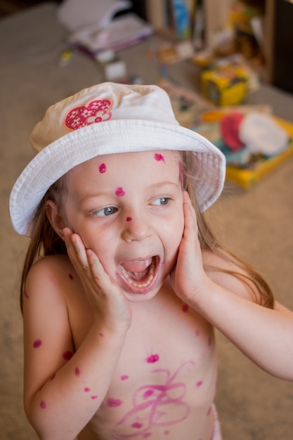 Little girl with red pimples crying at home