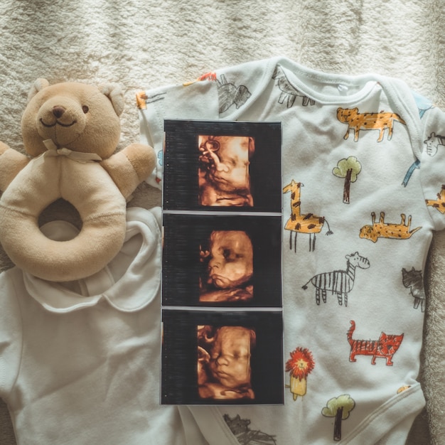 Little hand made baby clothes. Photo of ultrasound. newborn clothes. Unity, protection and happiness