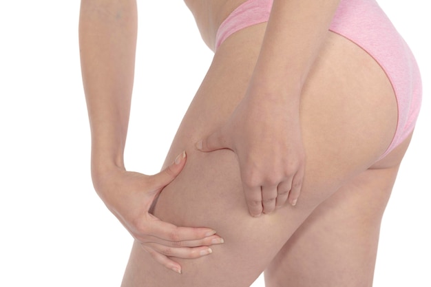 lose weight and liposuction cellulite removal concept, isolated on white background.