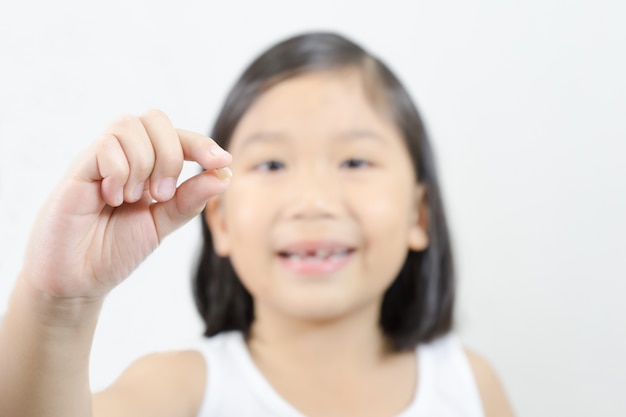 loss of a baby tooth