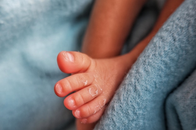 Piedi del neonato a sezione bassa