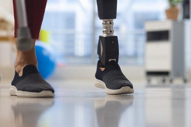 Photo low section of senior caucasian woman with artificial leg walking with crutches