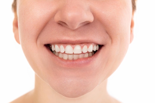 Lower half of woman face close up, smile with open mouth and white healthy teeth.