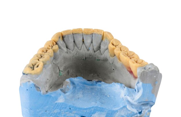 Photo lower jaw isolated