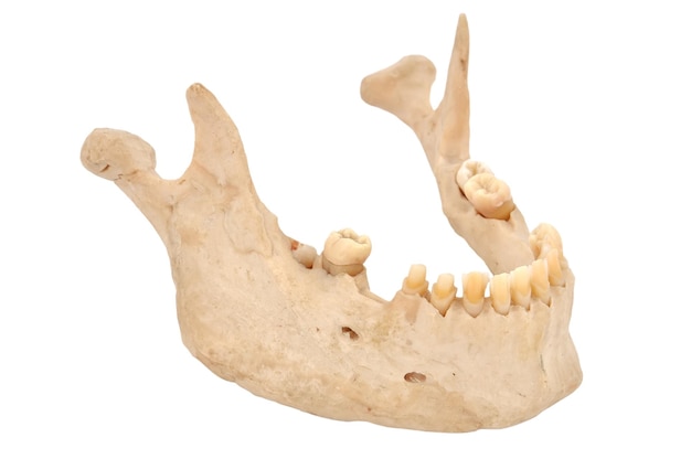 Lower jaw