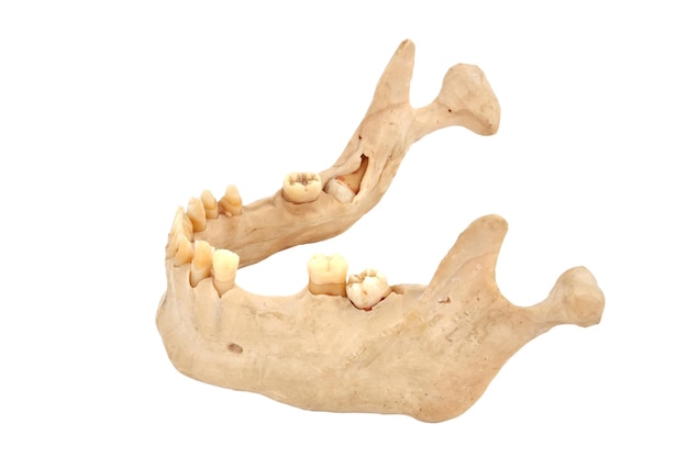 Lower jaw