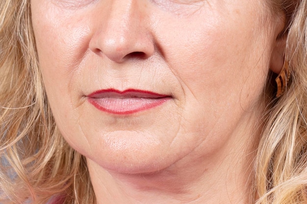 the lower part of the face and neck of an elderly woman with signs of skin aging
