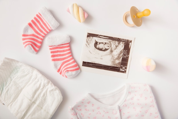 Luier; babykleren; heemst; sokken; fopspeen en echografie foto geïsoleerd op een witte achtergrond