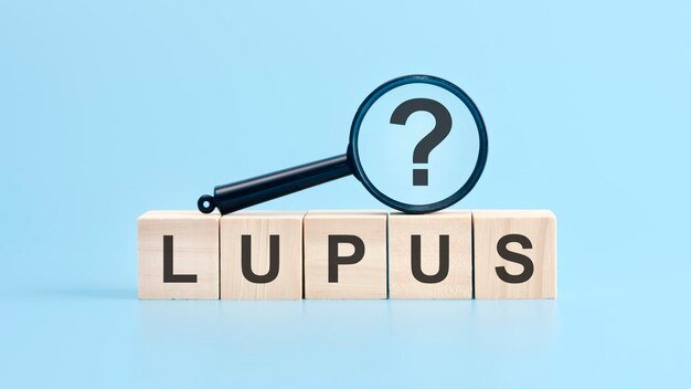 Foto lupus parola scritta su cubetti di legno lupus testo su tavolo concetto