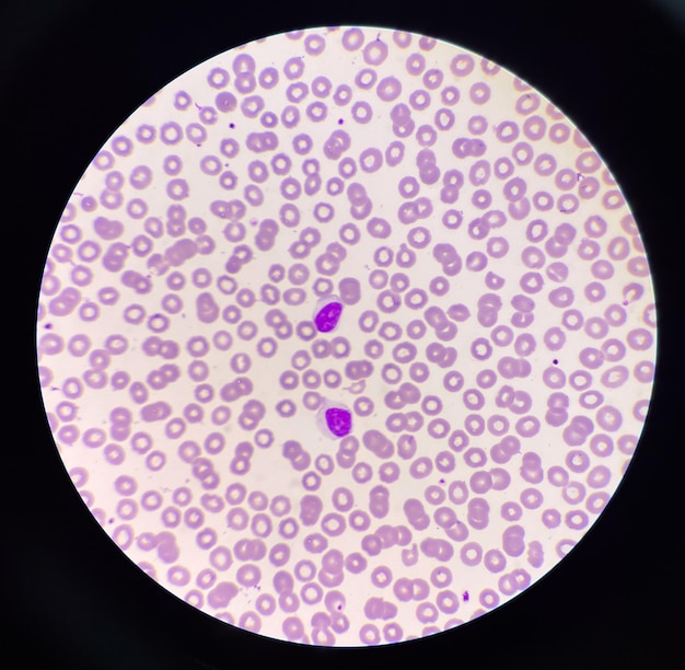 Lymphocyt WBC on red blood cell backgroundmedical background