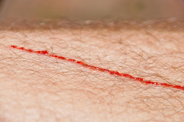 Photo macro shot of blood on skin