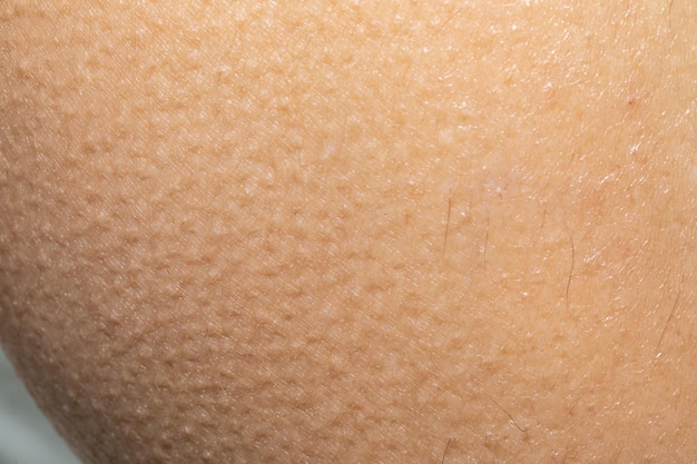 Macro of woman's skin with goosebumps