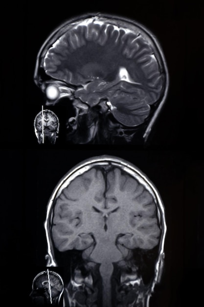 Macrofoto van computertomografie met de hersenen Medisch-wetenschappelijke en educatieve MRI van de hersenen