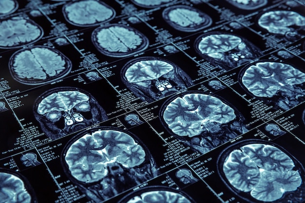 magnetic resonance imaging