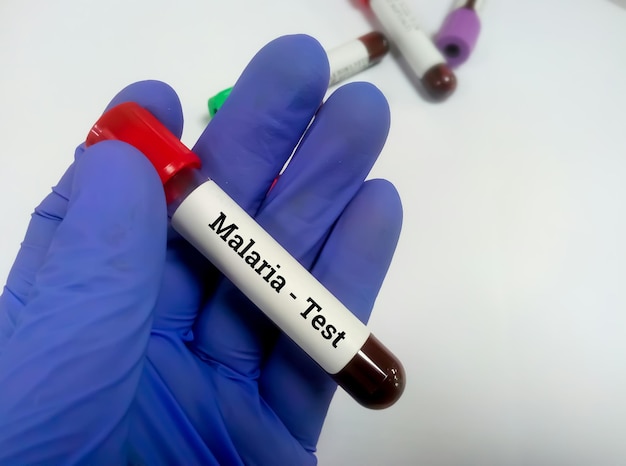 Malaria Infection testing concept