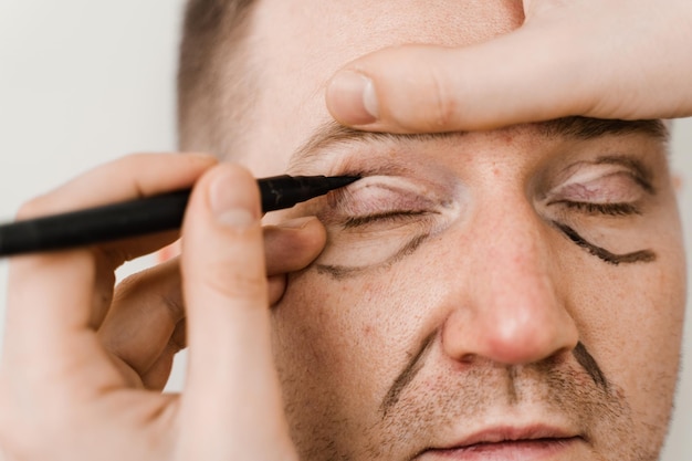 Male blepharoplasty for man markup Plastic surgeon draws markings on the eyelid before plastic surgery operation for modifying the eye region in medical clinic