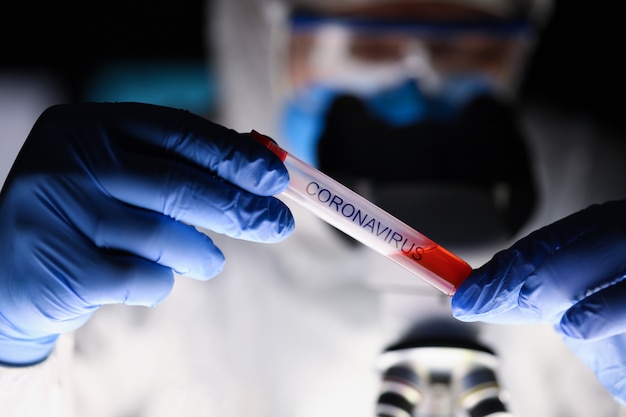 Male chemist hand in blue protective gloves hold