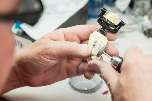 Foto odontotecnico maschio che lavora su uno stampo stampato in 3d per impianti dentali in laboratorio