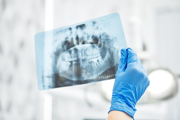 Photo male doctor holding and looking at dental xray