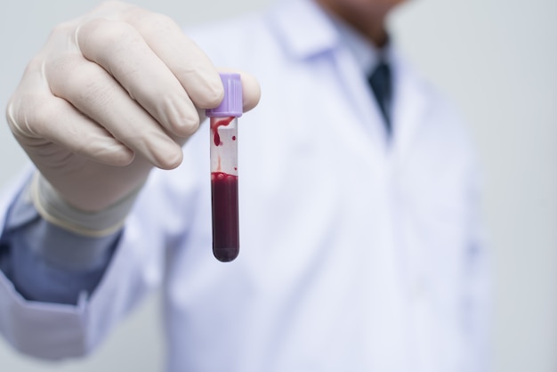 Male doctor showing tube of blood