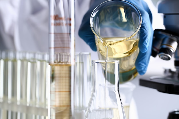 Male hand hold yellow liquid in test tube.