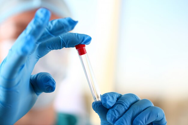 Male scientist holding empty vial