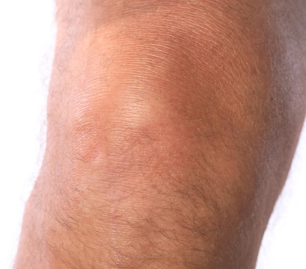 male sore knee isolated on white background