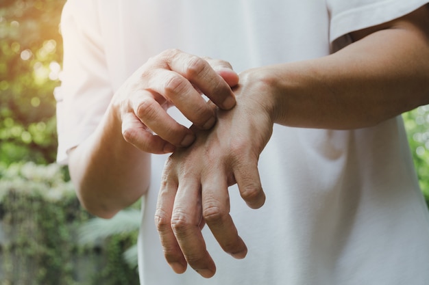 Man krabben jeuken met de hand. Mens die zijn concept van de handgezondheidszorg krassen.