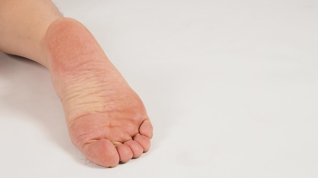 Man leg and barefoot on white background