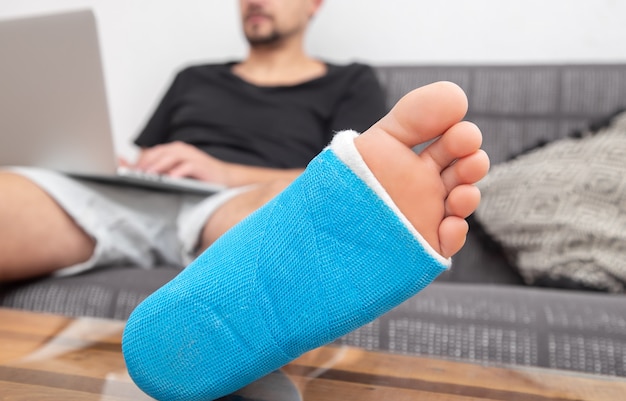 Man met gebroken been in het gips bezig met een laptop op de bank thuis.