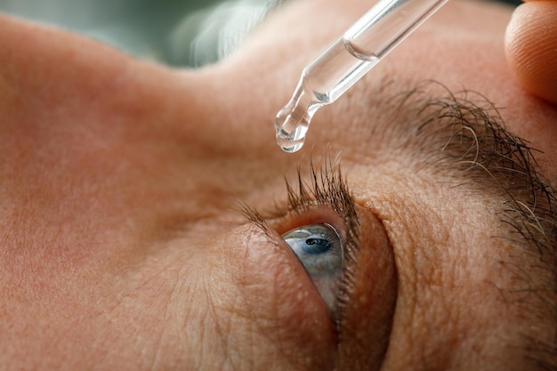 A man moistens his eyes before installing contact lenses. Drops in the eyes from irritation, redness and allergies.