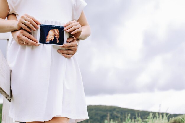 Man omhelst zijn zwangere vrouw en houdt een echografie bij de buik tegen een bewolkte hemel