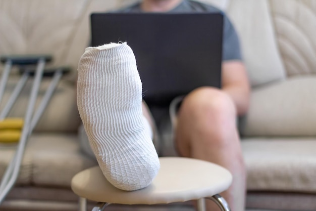 A man sits on a sofa in a cast with a laptop A leg in a cast lies on a chair