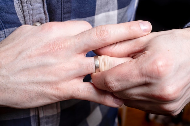 Фото Мужчина пытается снять обручальное кольцо с пальца