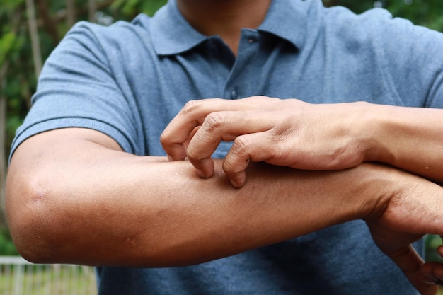 Man suffering from itching skin close up