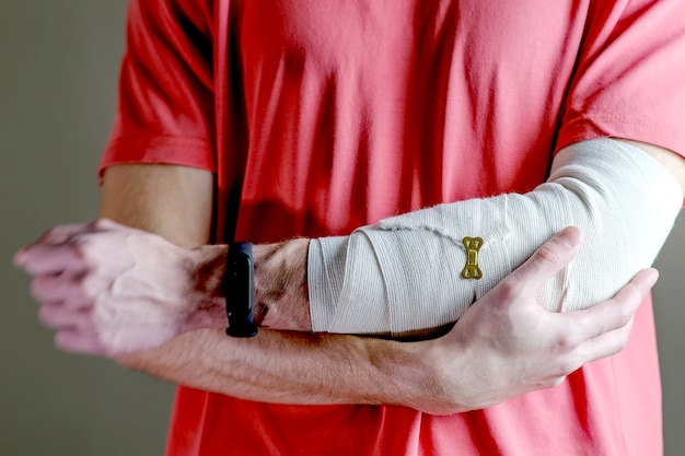 L'uomo sostiene la mano ferita. cure primarie la mano è fissata saldamente con un bendaggio elastico