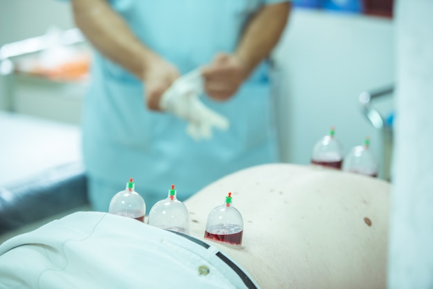 man taking cupping therapy for his body