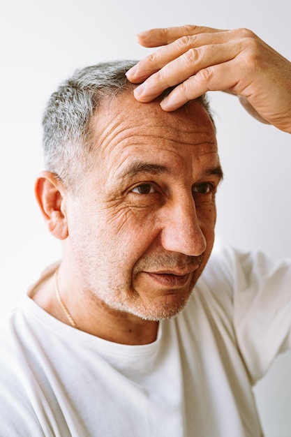 A man with a bald head is looking at the camera.