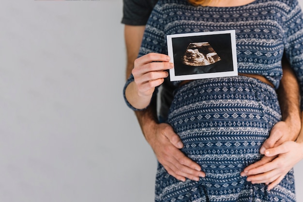 Photo man and woman with ultrasound