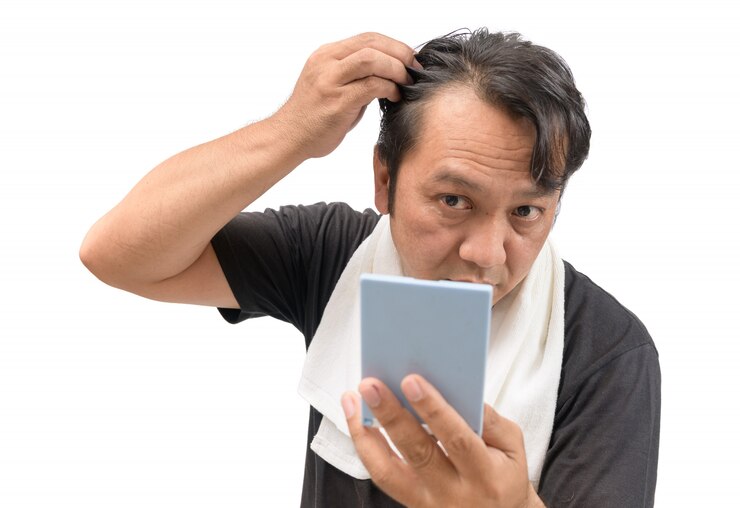Photo 男は彼の脱毛や脱毛症を心配している