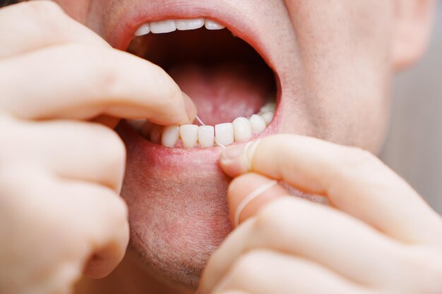 A man39s mouth closeup a man brush your teeth with dental floss