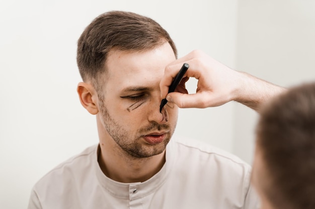 Mannelijke neuscorrectie markup close-up Blepharoplastie met hernia verwijdering markering op het gezicht vóór plastische chirurgie operatie voor het aanpassen van de oogregio en het hervormen van de neus voor verandering van uiterlijk