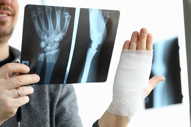 Mannelijke patiënt houdt in hand CT-scan van zijn gebroken arm