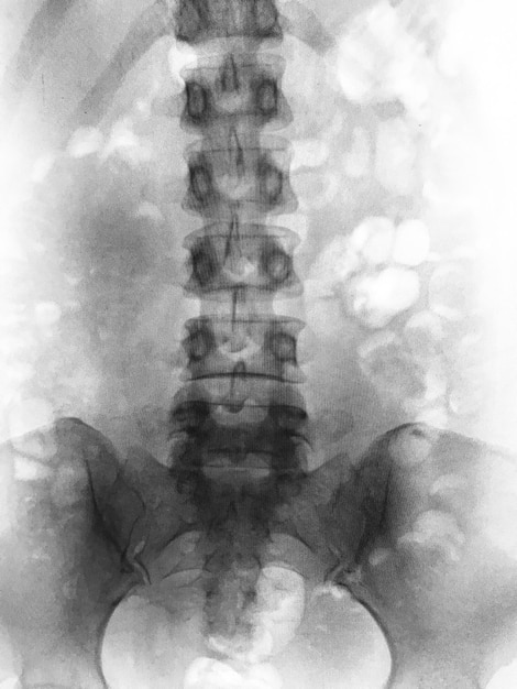 写真 非常に高品質の x 線画像が多数あります