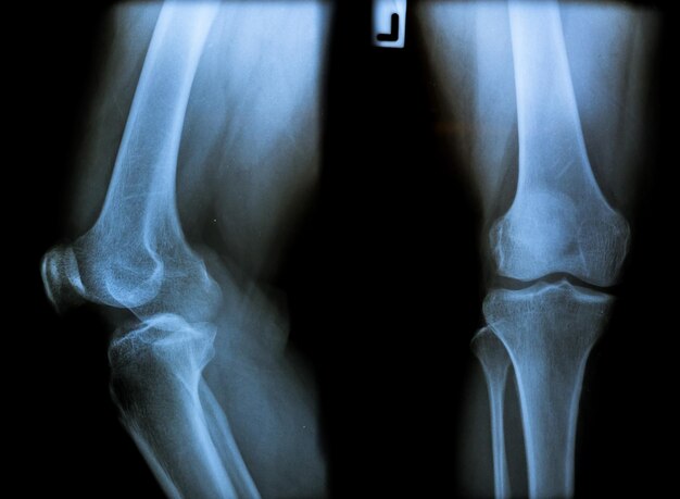 사진 아주 좋은 품질의 많은 xray 이미지