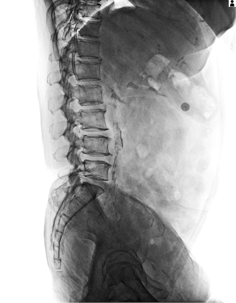 写真 非常に良い品質の多くのx線画像